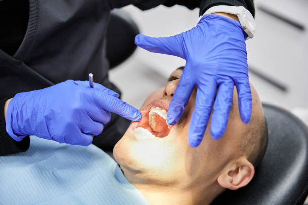 Best Knocked-Out Tooth Emergency  in Mattydale, NY