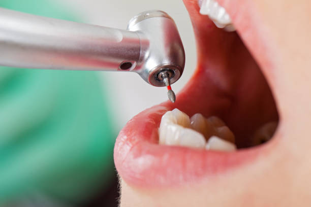 Best Urgent Tooth Repair  in Mattydale, NY